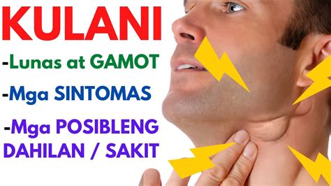underarm rashes sa kilikili|Home Remedy For Kulani Sa Kilikili .